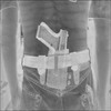 röntgenstralen brengen u en anderen rondom u ernstige schade toe